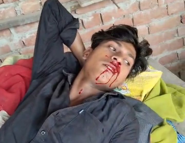 फुलपुर में मजदूर को पटक-पटककर पीटा, DCP गोमती जोन के आदेश पर 7 पर मुकदमा