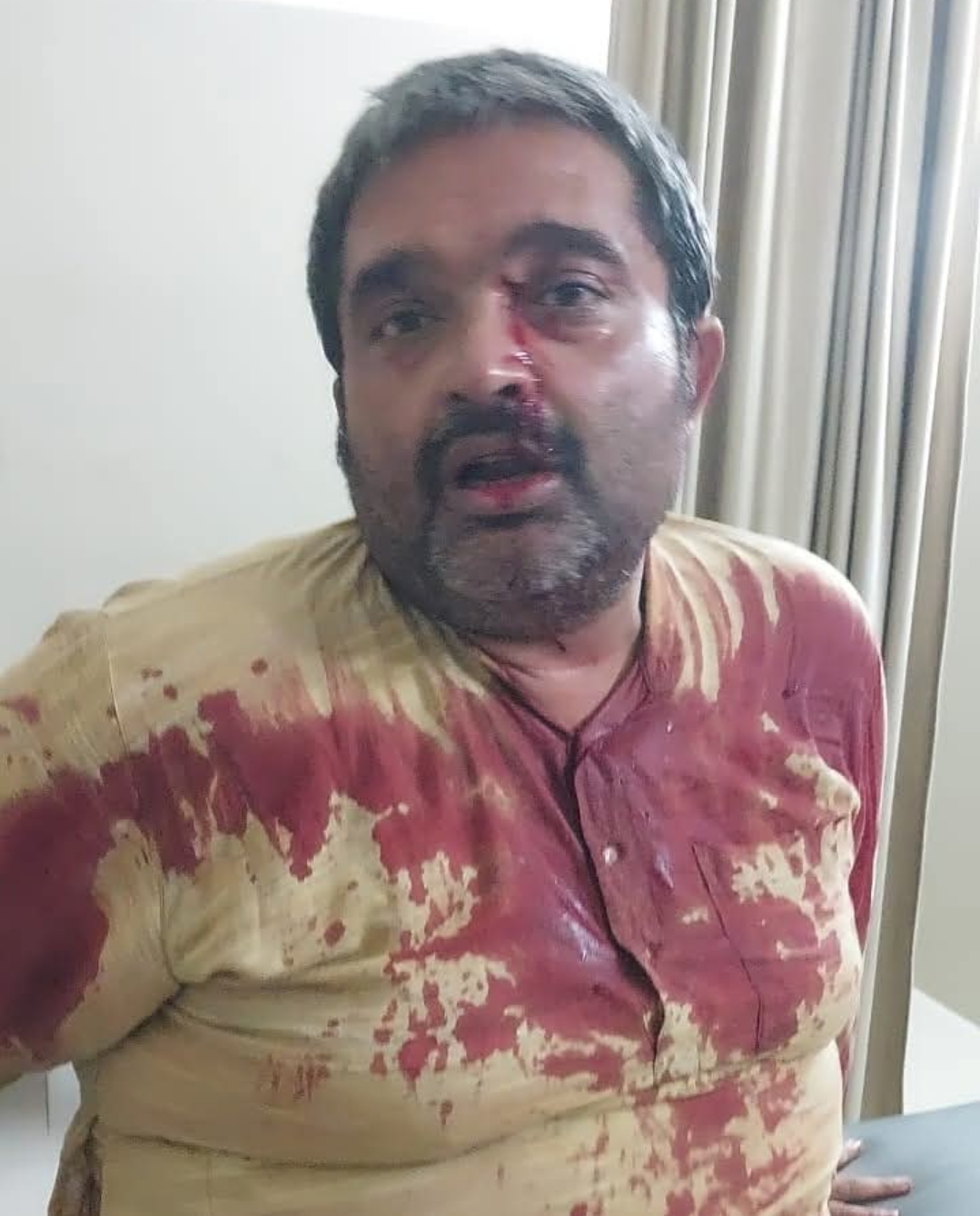 अधिवक्ताओं के तेवर भांप कर बैकफुट पर आया पुलिस प्रशासन