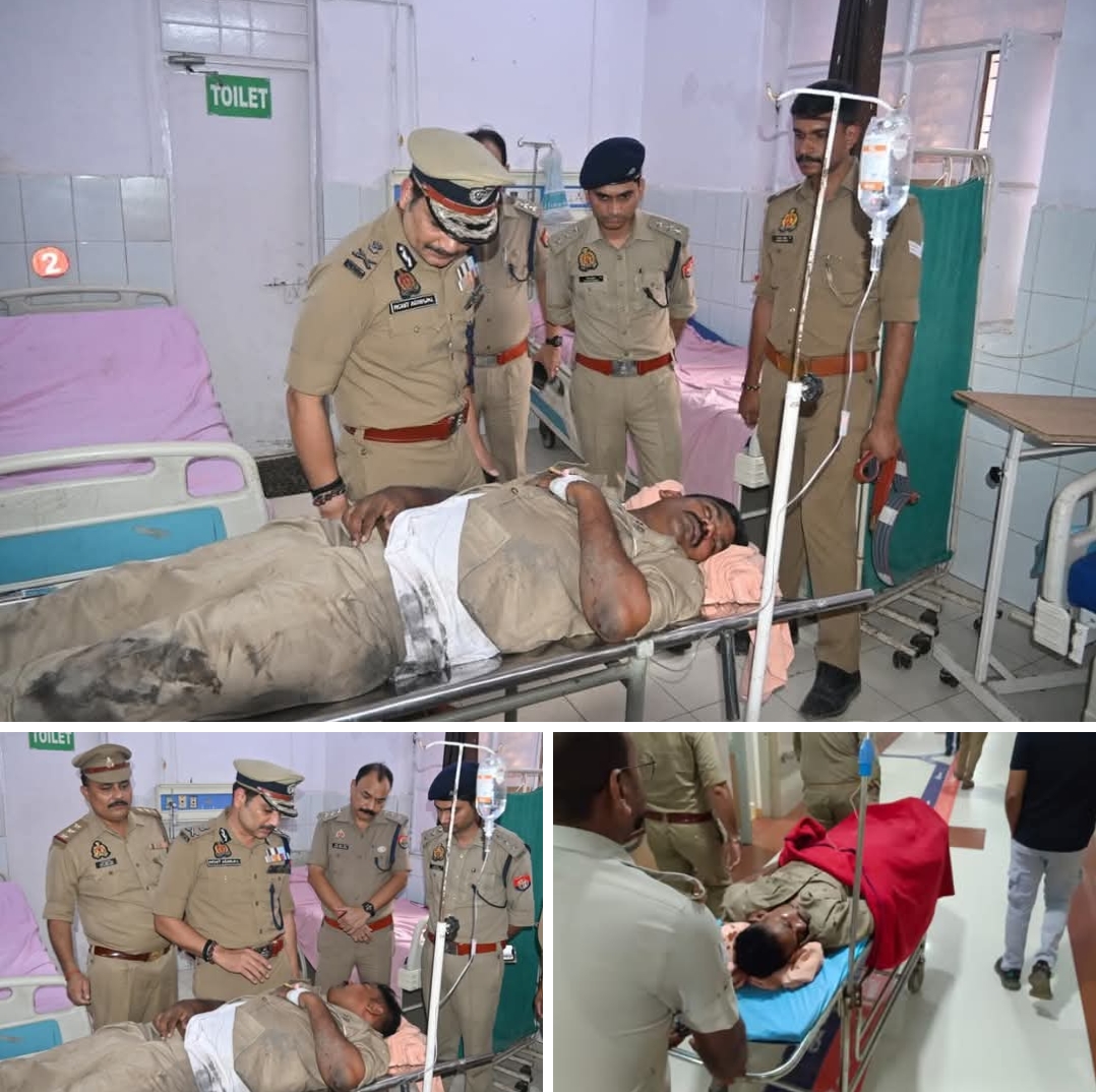 कचहरी कांड: घायल दरोगा से मिलने BHU ट्रॉमा सेंटर पहुंचे पुलिस कमिश्नर, दिए बेहतर इलाज के निर्देश