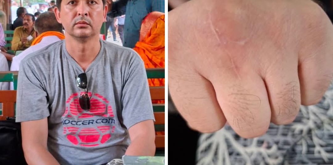 वाराणसी में विदेशी नागरिक से ₹11 लाख से अधिक की ठगी! अस्पताल और डॉक्टर पर गंभीर आरोप